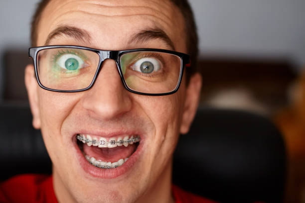 how much are braces